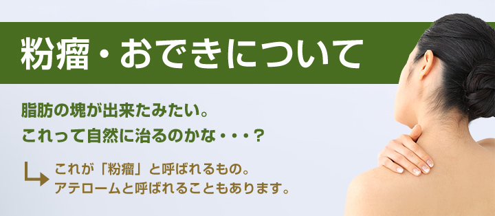 粉瘤 アテローム 日帰り手術 費用 群馬県高崎市の皮膚科 あすなろクリニック